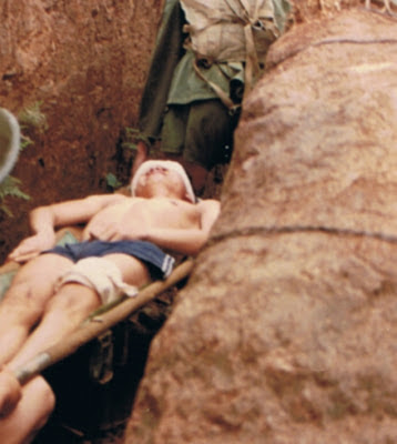 Binh sĩ của Sư đoàn 67 bị tử thương, tại trận chiến Lão Sơn, ngày 6 tháng 1/1987. Ảnh: NF3.86.