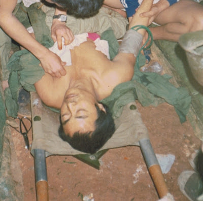 Binh sĩ của Sư đoàn 67 bị thương, tại trận chiến Lão Sơn lưng núi Lão Sơn, ngày 6 tháng 1-1987. Ảnh: NF3.86.